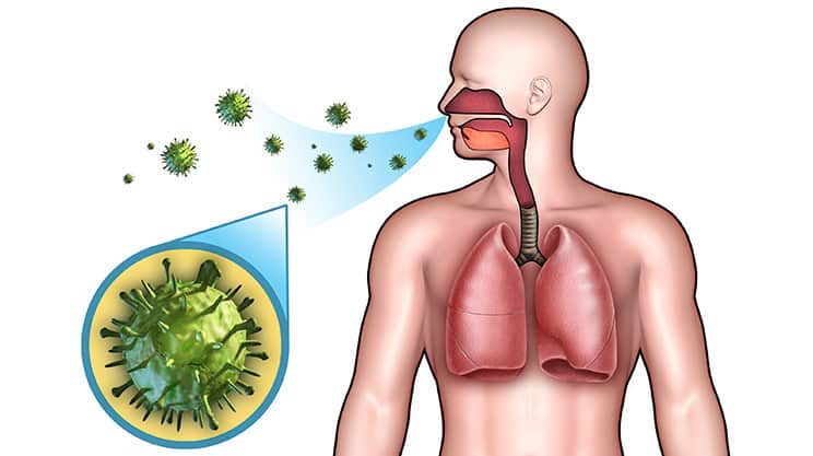 Lungenentzündung oder Bronchitis