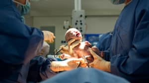 Ablauf eines Kaiserschnitts - was passiert bei der operativen Entbindung?