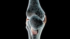 Der Kreuzbandriss - schmerzhafte Probleme mit dem Knie