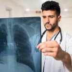 Welche Symptome einer Lungenembolie gibt es?