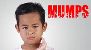 Wie gefährlich ist die Kinderkrankheit Mumps?