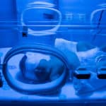 Wie wird eine Neugeborenengelbsucht nach der Geburt behandelt?