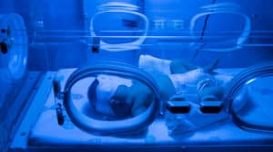 Wie wird eine Neugeborenengelbsucht nach der Geburt behandelt?