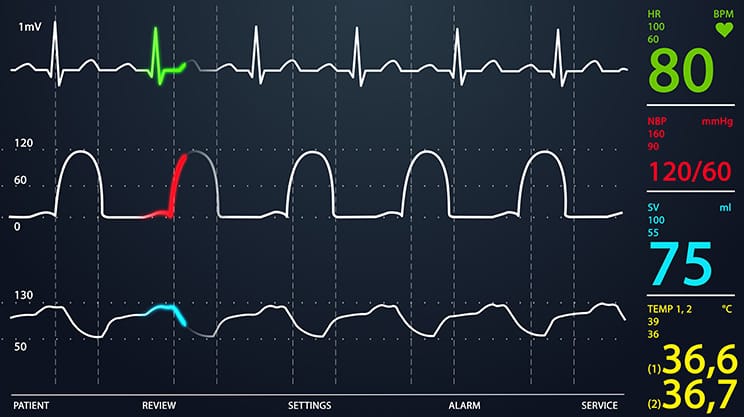Was passiert bei einer Herzschrittmacher Operation?