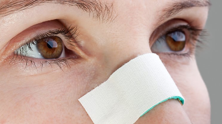 Nasenbeinbruch – die häufigste Gesichtsverletzung
