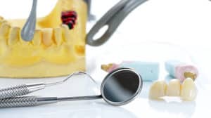 Implantologie - mehr als nur ein Zahnersatz