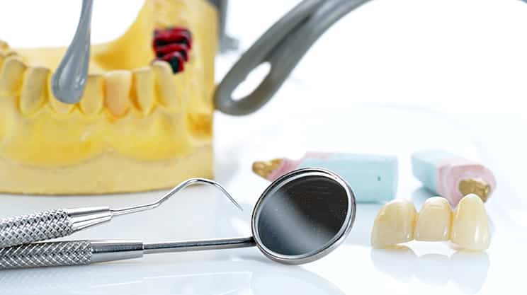Implantologie – mehr als nur ein Zahnersatz
