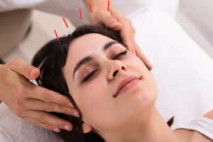 Kann Akupunktur bei Kopfschmerzen helfen?