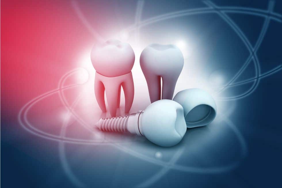 Wie die 3D-Technik die Dentalmedizin verändert